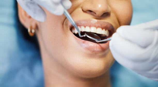 Best Emergency Tooth Extraction in Rineyville, KY