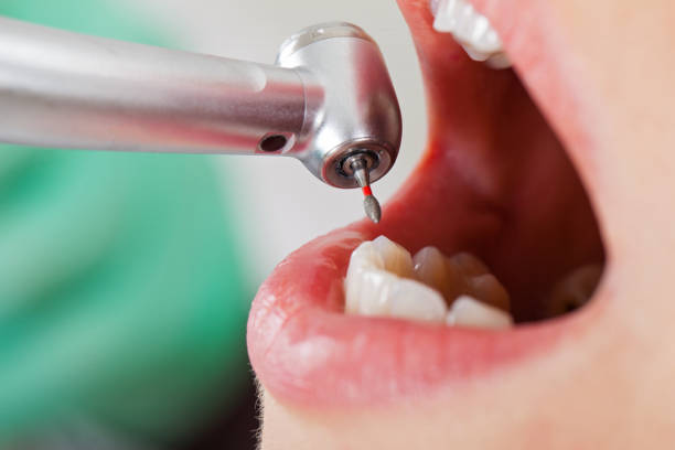 Best Emergency Treatment for Dental Infections or Abscesses in Rineyville, KY